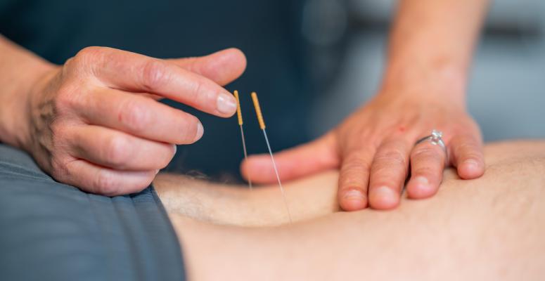 Dry Needling